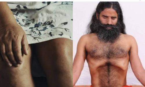 सर्दी में बढ़ जाता है गठिया का दर्द, बाबा रामदेव से जानें घुटनों और जोड़ों को कैसे रखें स्वस्थ